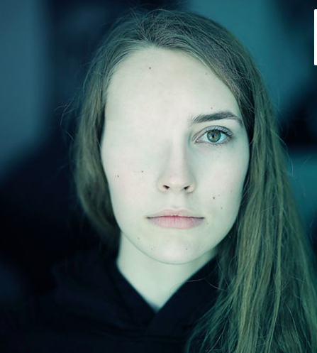 Photo du visage d'une jeune femme dont l'un des yeux est couvert par de la peau.